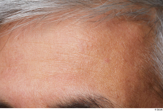HD Face Skin Reuben Panjaitan face forehead skin pores skin…
